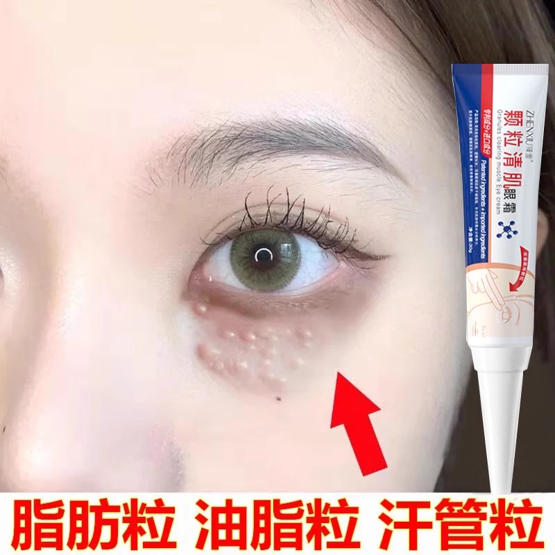 【眼部颗粒自己走】去脂肪粒眼霜