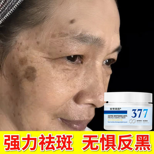 【科技美白祛斑】摆脱斑点肌