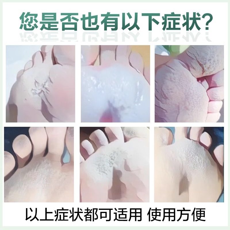 脚汗喷雾汗脚神器止汗剂去脚汗治脚出汗臭脚脚粉防酸臭