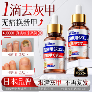 日本灰指甲阿莫罗芬搽正品旗舰店专用抑菌液趾指甲膏冰醋酸涂剂bx