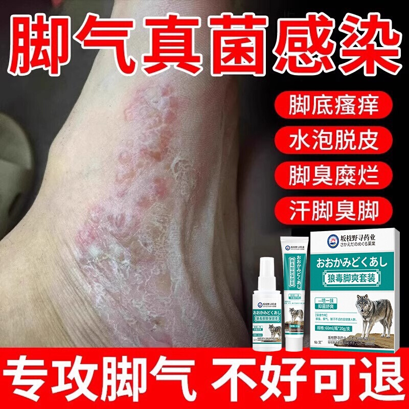 脚气喷雾止脱皮痒杀菌