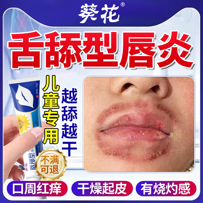 舌舔唇炎专用润唇膏儿童嘴唇防干裂脱皮医用型治剥脱性口角炎cc