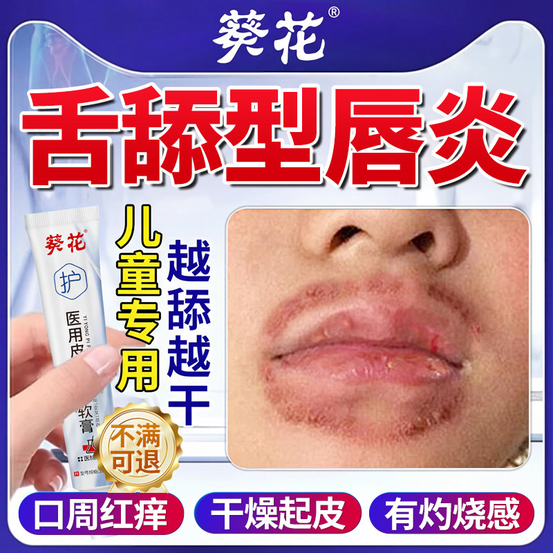 舌舔唇炎专用润唇膏儿童嘴唇防干裂脱皮医用型治剥脱性口角炎cc