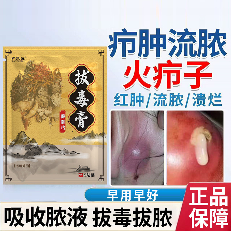 古法熬制拔毒黑膏贴痘痘硬块