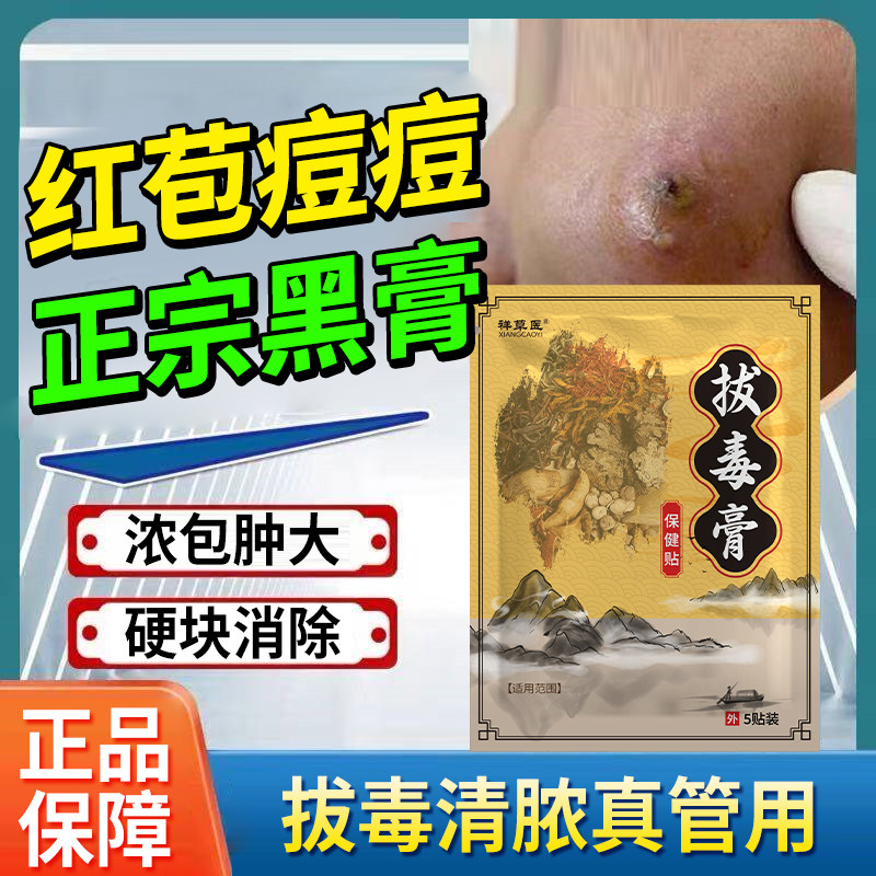 拔毒拔脓黑膏贴屁股脓包大红包坐板疮红肿硬块火疖子痘痘痛黑膏贴