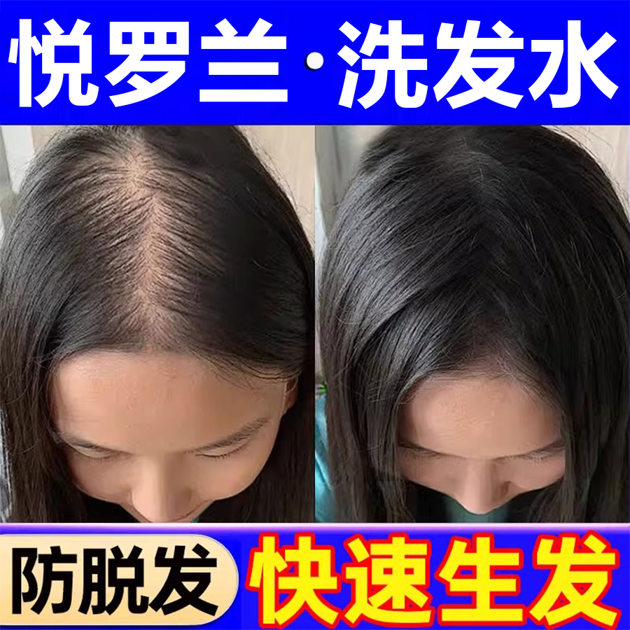 悅罗兰洗发水防脱育发生发密发去屑止痒控油蓬松官方正品