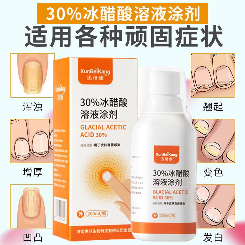 迅倍康30%冰醋酸溶液涂剂稀释液外用抑菌液