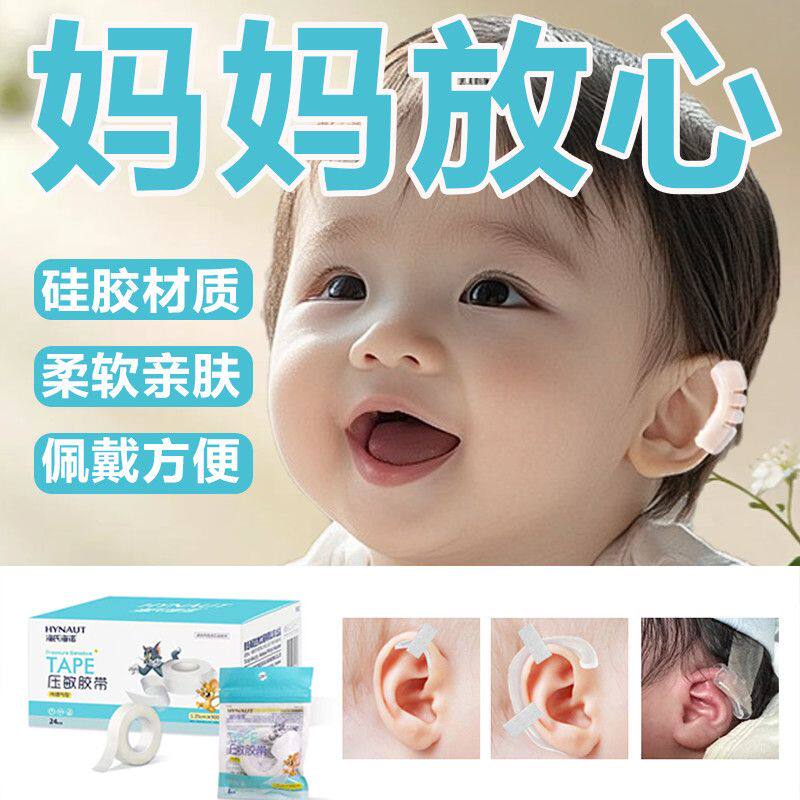 婴儿耳廓矫正器朵定型贴