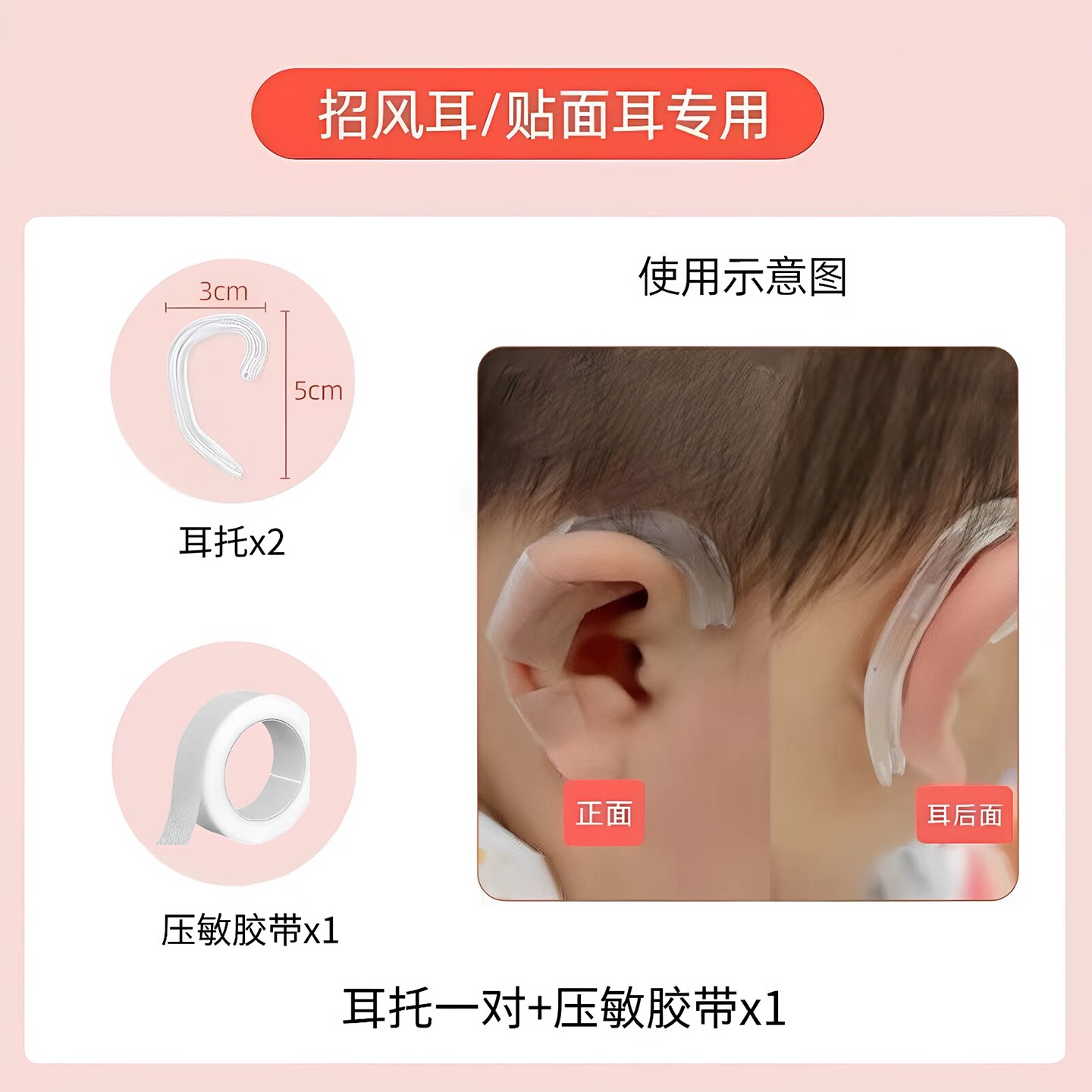 耳朵矫正器婴儿新生的廓