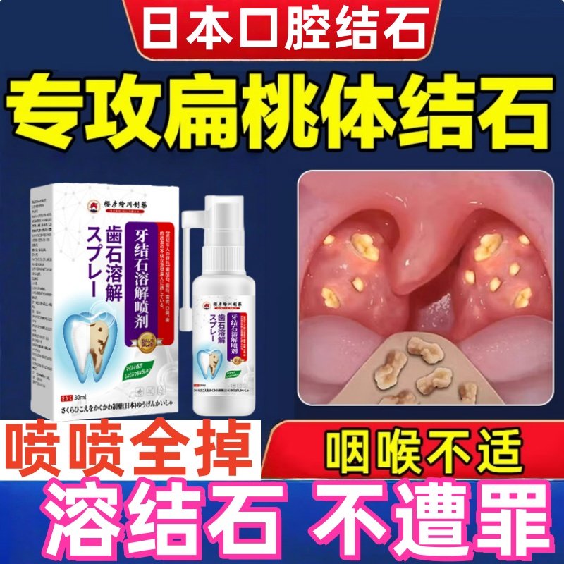 扁桃体结石去除工具漱口水喷剂清理神器隐窝冲洗器口腔异味漱口水,洗护清洁剂/卫生巾/纸/香薰,牙刷/口腔清洁工具,淘宝优惠券,粉丝福利购,淘宝优惠卷