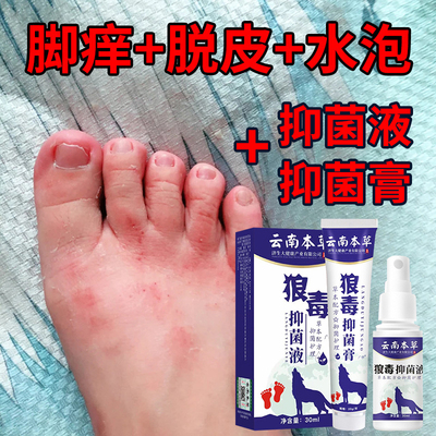 花安乐脚气喷剂止去脚痒脚臭脚汗脱皮佳和足舒美水泡型烂脚丫脚裂