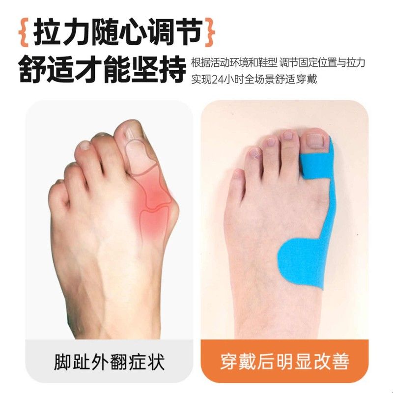 拇指外翻辅助矫正带肌肉贴大脚趾防磨护套透气可穿鞋关节固定绷带
