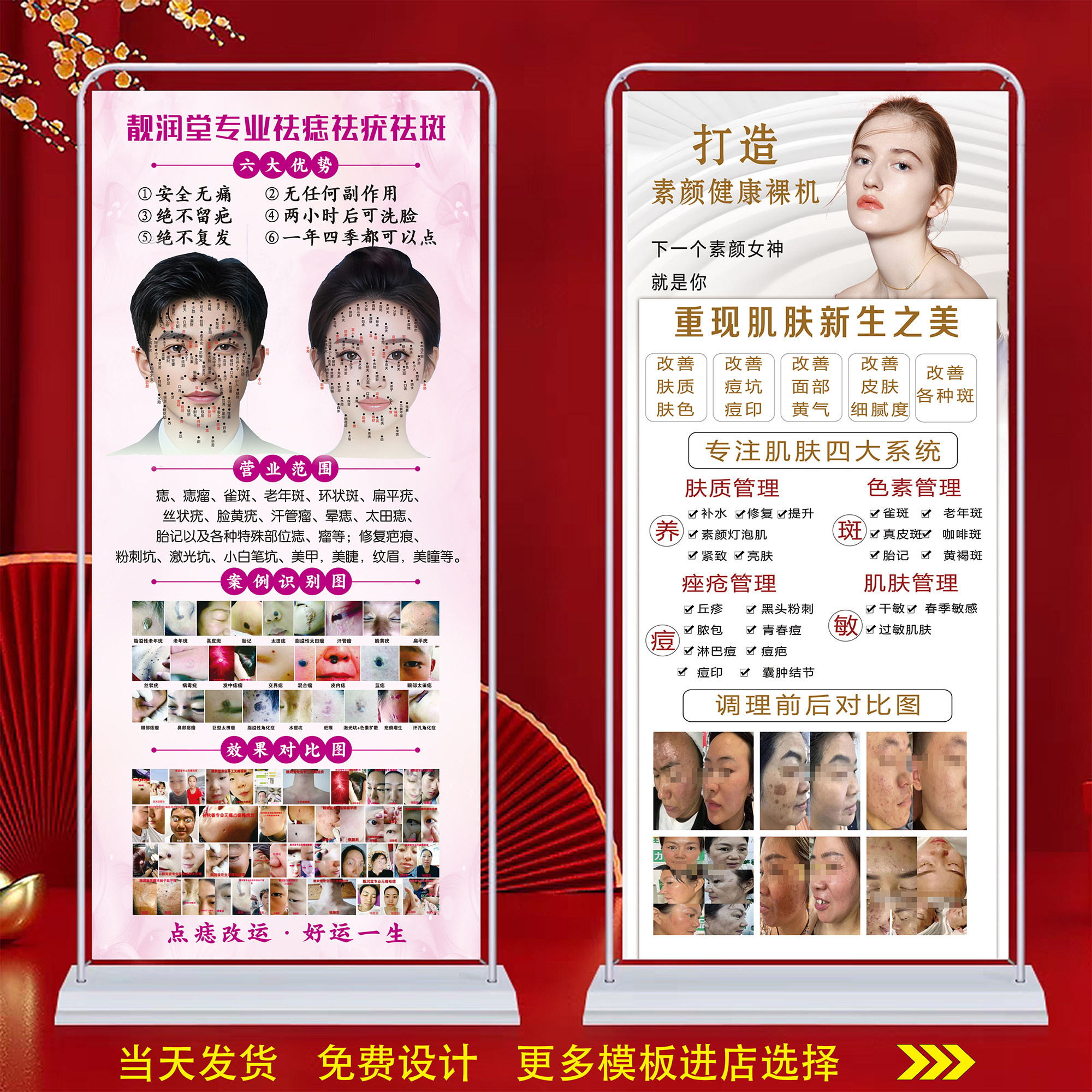 美容院问题性皮肤点痣祛斑广告挂图门型展架户外贴纸定制祛痣祛疣