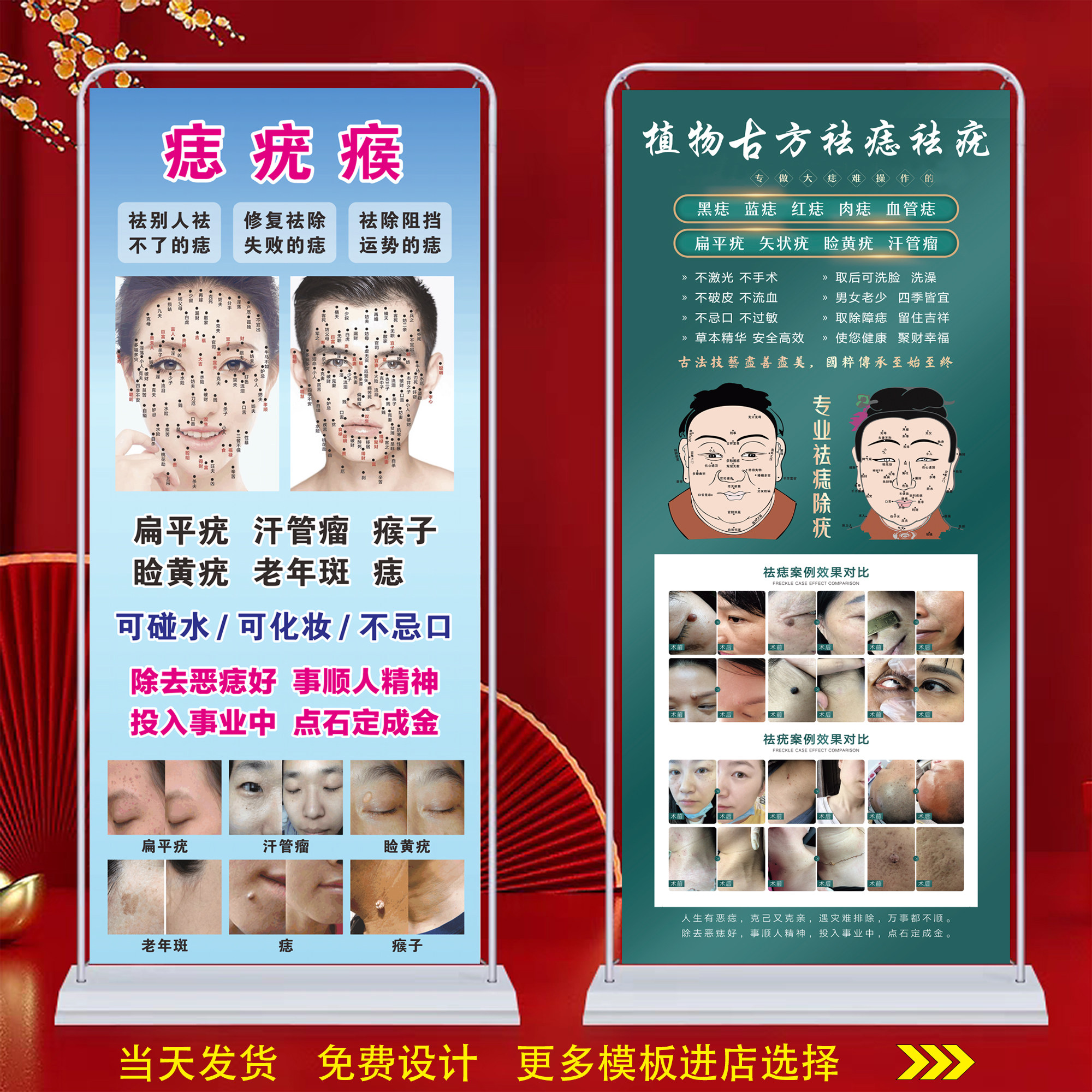 祛斑祛痣广告挂图宣传海报门型x展架户外贴纸定制祛痣祛疣宣传图