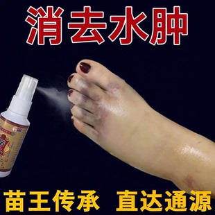 苗王 去水肿消 肿专用的药老人脚肿消水肿止疼痛活络血化瘀喷雾剂