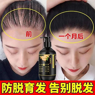 高缇雅老姜王防脱发洗发水生姜精华生发增发密发固止痒控油洗发露