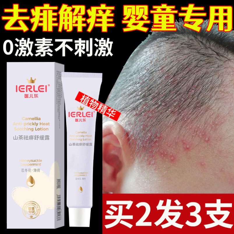 宝宝痱子膏止去痱子痒婴儿专用菲子粉儿童热痱子水药膏新生儿祛痱