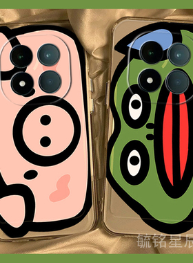 适用小米redmi红米note15pro手机壳note14pro+新款13r可爱12t小猪12se绿色11tpro十11e青蛙11r搞怪10透明的软