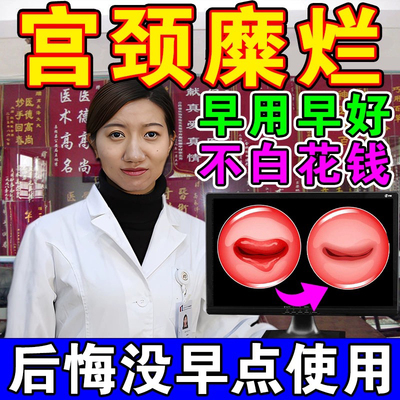 甲硝唑阴道清洗液霉菌性阴道炎细菌滴虫性瘙痒私处洗护液氯己定洗