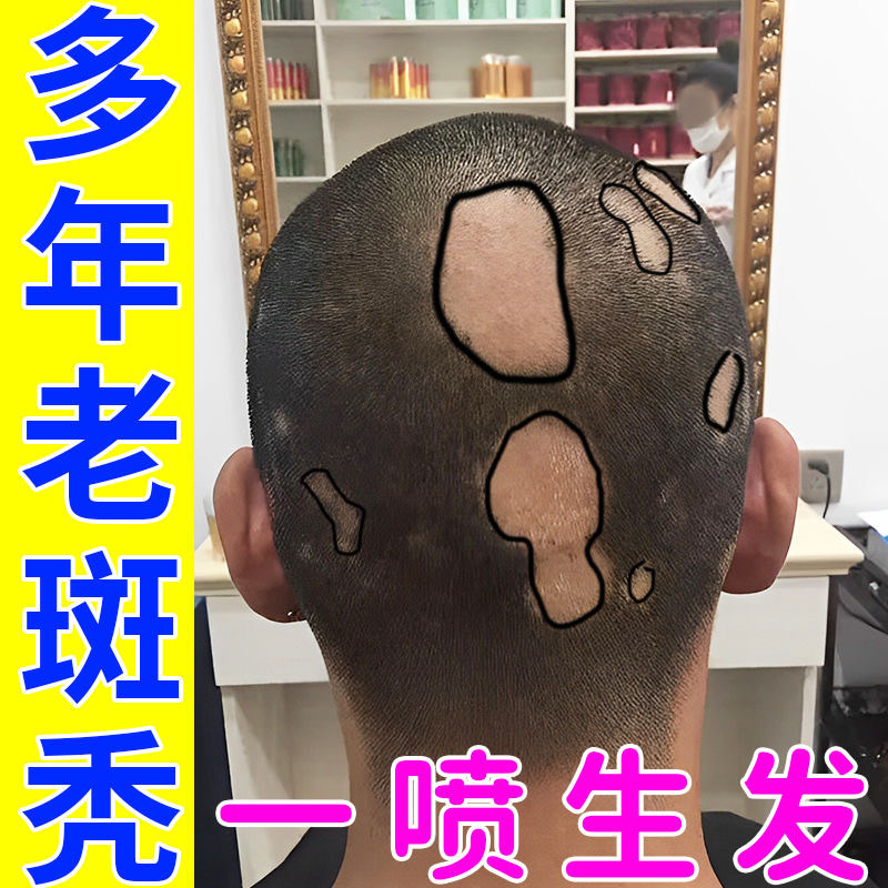 固肾生发丸同仁堂益肾乌发口服液固发生发内调补肾防脱秃头