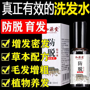 发迹米诺地尔酊生发液用于治疗男性型脱发斑秃生发防脱发增发YP