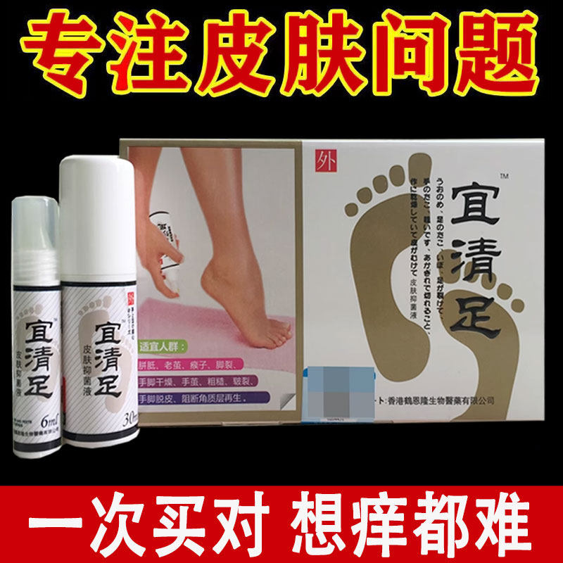 正品宜清足皮肤抑菌液脚垫老茧膏脚茧脚底硬皮死皮足部茧灵