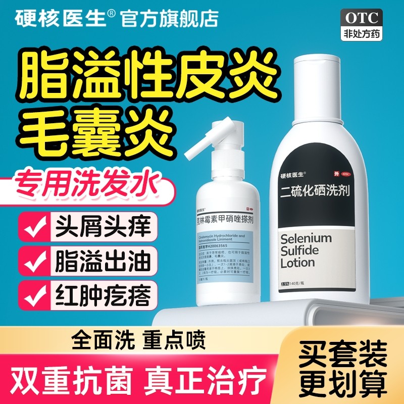 脂溢性皮炎毛囊炎专用去屑止痒抑菌二硫化硒洗发水膏露喷剂头皮部