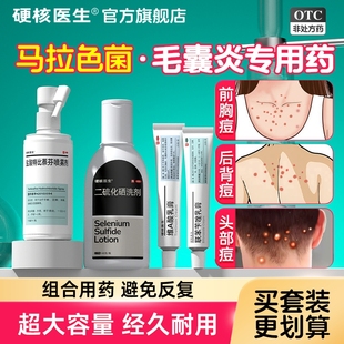 治疗马拉色菌毛囊炎后背部前胸祛痘长痘痘专用特效喷雾剂除螨药膏