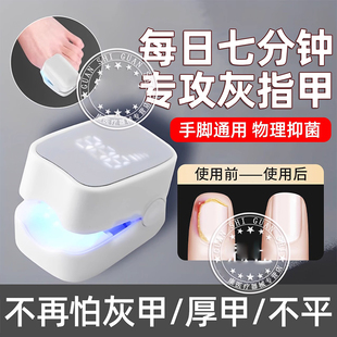 灰指甲光疗机真菌灯脚指甲紫外线光疗仪激光家用辅助工具理疗仪