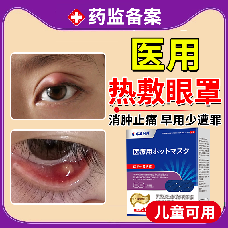 医用热敷眼罩】霰粒肿睑板腺囊肿