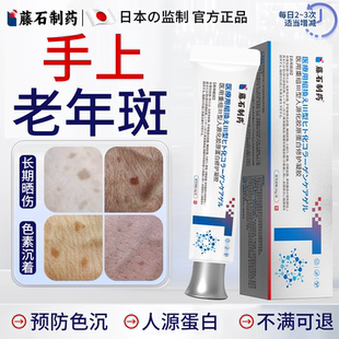 手上手背老年斑强力去除手部脸部扁平疣专用的药房膏一抹净斑点OZ