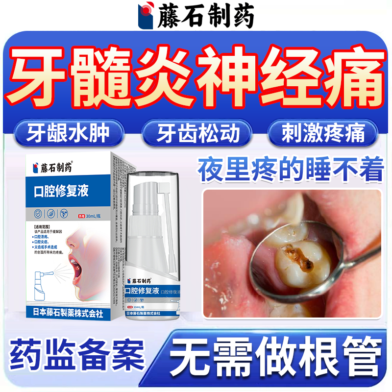 【医用级】牙髓炎神经止痛喷剂