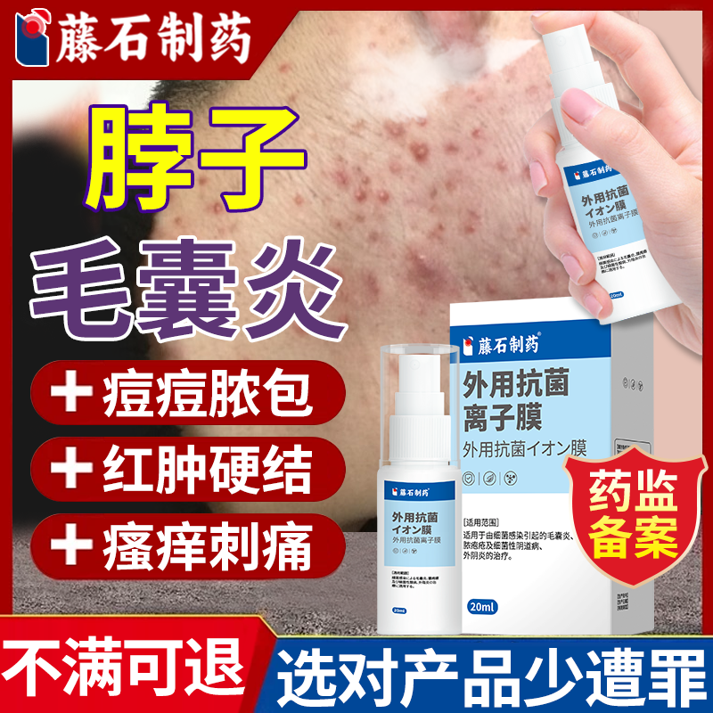 不满可退】脖子上长痘毛囊炎喷剂