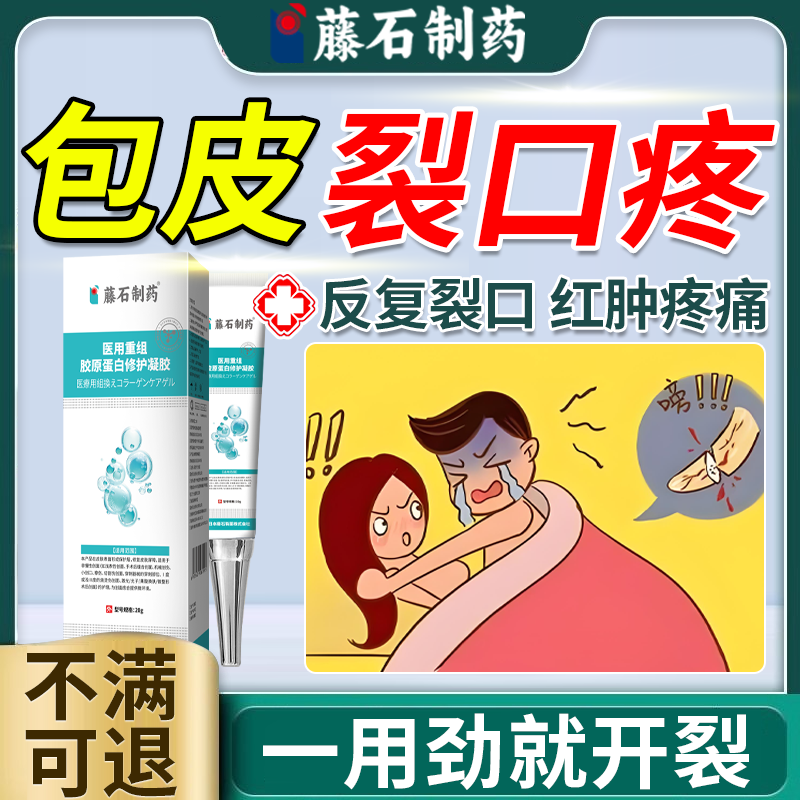 剧烈摩擦包皮裂口红肿疼痛瘙痒膏