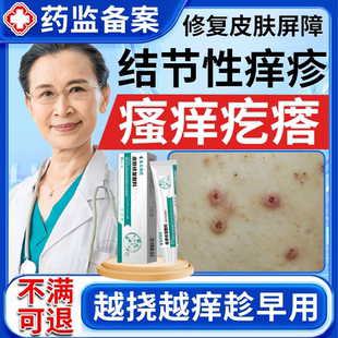 结节性痒疹专用皮肤湿疹特治顽固红硬疙瘩效拔毒止痒药房同款膏BS