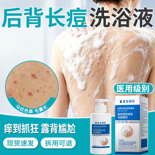 【医用级】去后背痘毛囊炎沐浴液