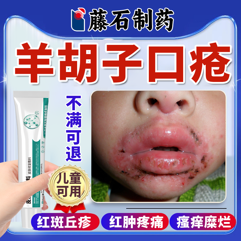 口周脓包丘疹、红肿疼痛、糜烂结痂、瘙痒