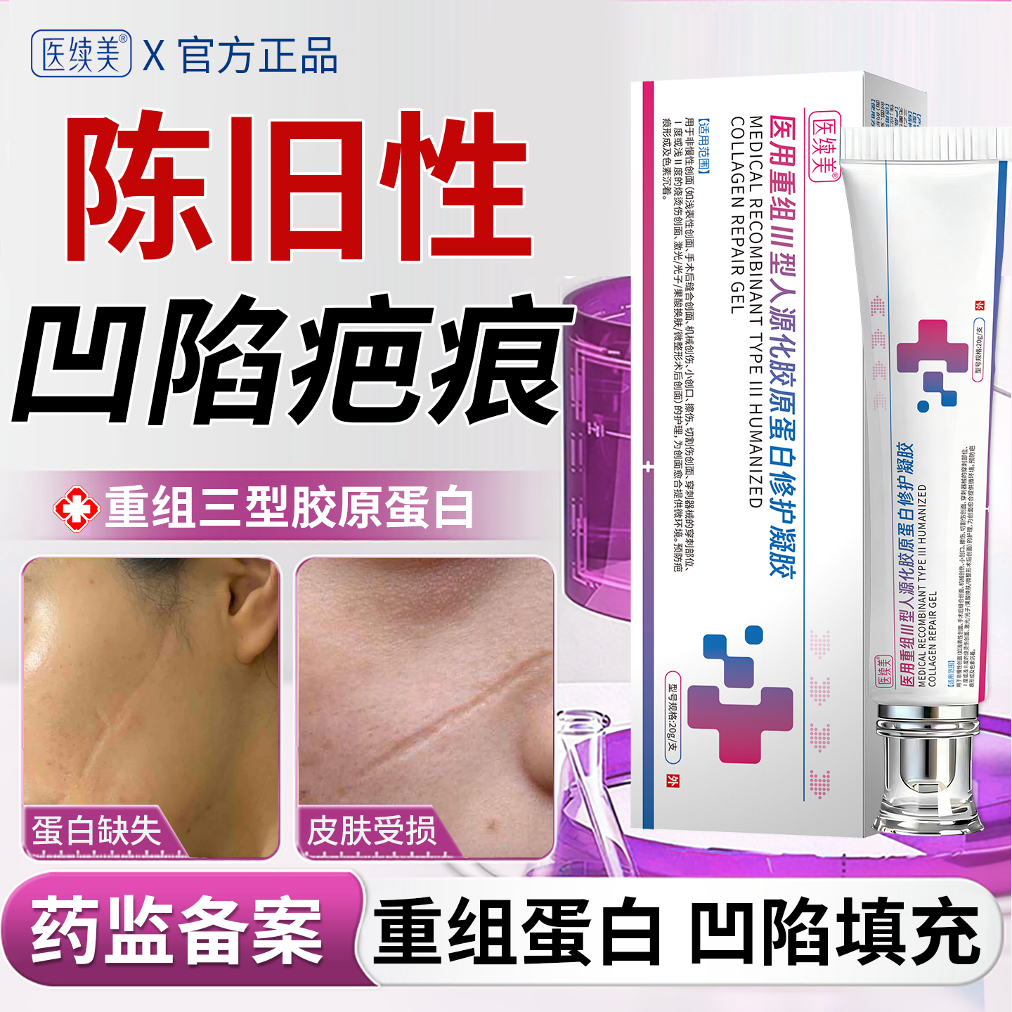 医用重组三型人源化胶原蛋白陈旧性凹陷性疤痕修复填充生长因子EM - 实物图