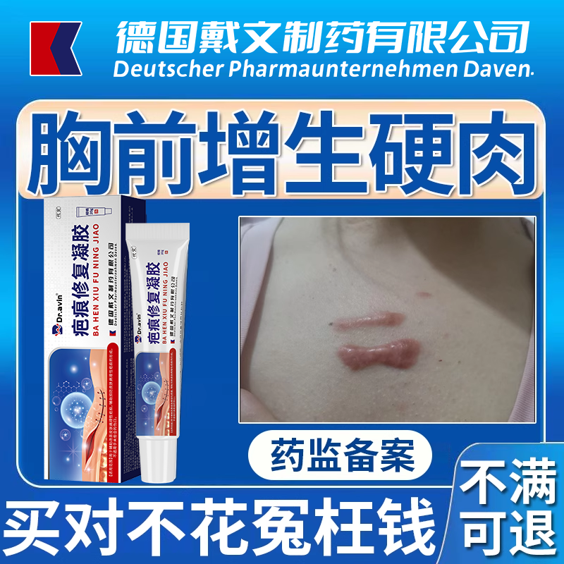 胸前疤痕增生疙瘩痒祛疤膏