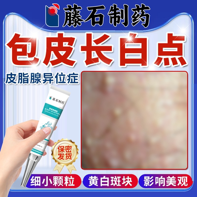 【直击包皮长白点】男士专用膏