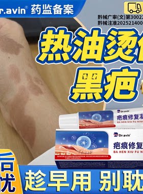 热油烫伤黑印疤痕修复医用除疤膏