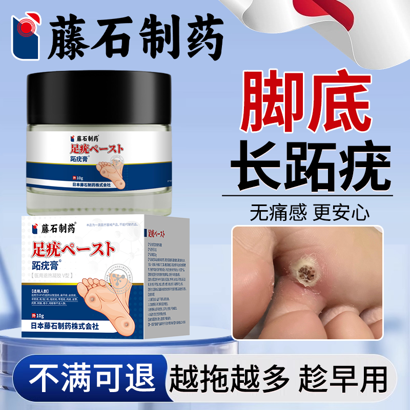脚底长跖疣】周期涂抹不满可退