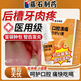 后槽牙牙龈脓包肿痛消智齿冠周炎专用上火口腔护理喷雾药房同款BS