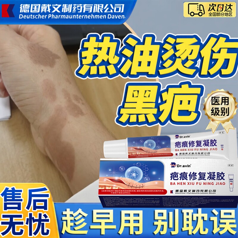 油溅被热油烫伤烧伤去疤膏疤痕修复凝胶去黑疤印色素沉淀除疤膏BS