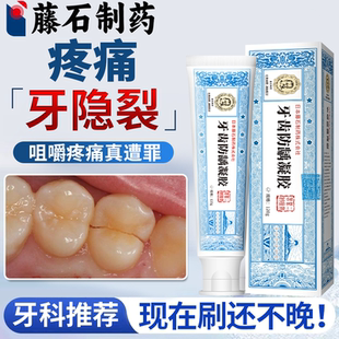 牙齿有裂纹裂开牙裂缝修补牙隐裂修可搭牙膏用复断裂牙裂生长液OZ