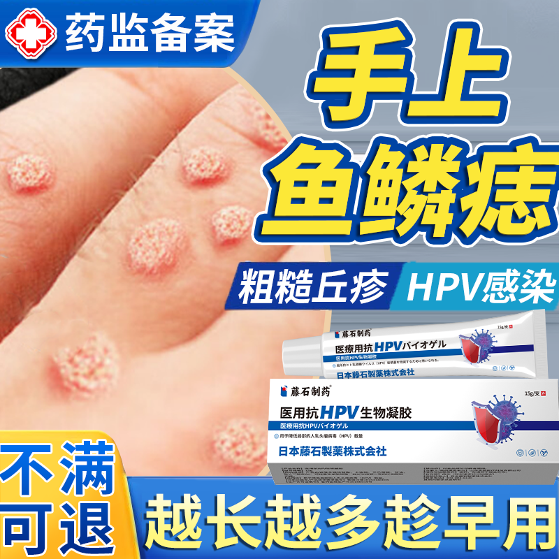 手上鱼鳞痣HPV病毒感染专用膏