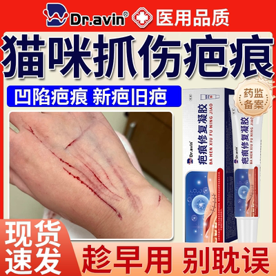 猫咪抓伤疤痕修复祛疤膏儿童可用