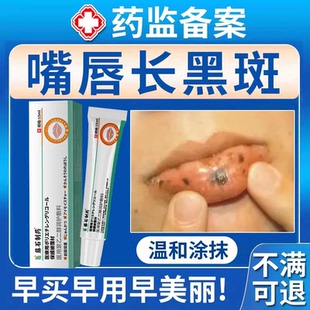嘴唇黑斑黑点黑色素黑痣唇炎发黑发紫去除淡化周围去黑色素沉淀BS