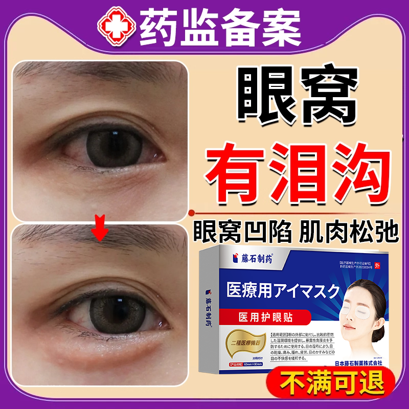 眼窝有泪沟不用怕冷敷眼贴贴一贴