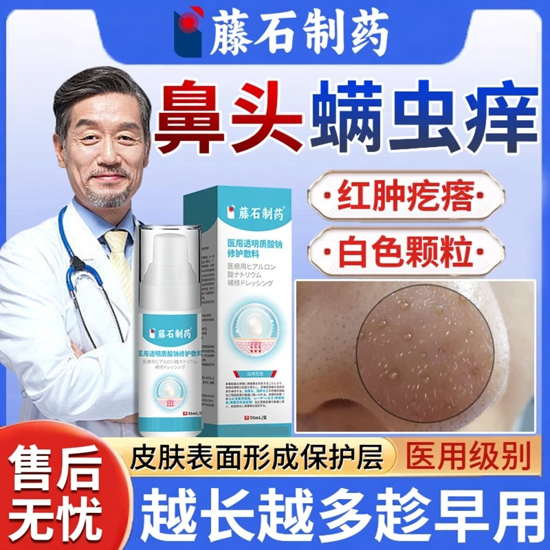 鼻子去除螨虫神器鼻头痒脸部酒糟鼻专用痤疮护肤药房同售止痒膏BS